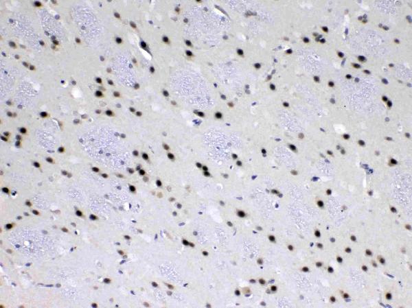 IHC analysis of MED18 using anti-MED18 antibody (A10600-2). MED18 was detected in paraffin-embedded section of rat brain tissue. Heat mediated antigen retrieval was performed in citrate buffer (pH6, epitope retrieval solution) for 20 mins. The tissue section was blocked with 10% goat serum. The tissue section was then incubated with 1ug/ml rabbit anti-MED18 Antibody (A10600-2) overnight at 4 Biotinylated goat anti-rabbit IgG was used as secondary antibody and incubated for 30 minutes at 37 The tissue section was developed using Strepavidin-Biotin-Complex (SABC)(Catalog # SA1022) with DAB as the chromogen.