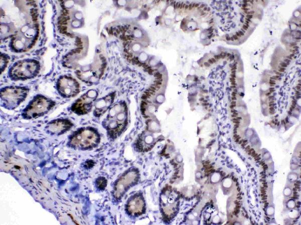 IHC analysis of MED18 using anti-MED18 antibody (A10600-2). MED18 was detected in paraffin-embedded section of rat small intestine tissue. Heat mediated antigen retrieval was performed in citrate buffer (pH6, epitope retrieval solution) for 20 mins. The tissue section was blocked with 10% goat serum. The tissue section was then incubated with 1ug/ml rabbit anti-MED18 Antibody (A10600-2) overnight at 4 Biotinylated goat anti-rabbit IgG was used as secondary antibody and incubated for 30 minutes at 37 The tissue section was developed using Strepavidin-Biotin-Complex (SABC)(Catalog # SA1022) with DAB as the chromogen.