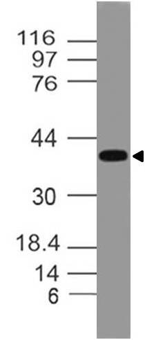 A11263 Western Blotting Analysis 20 1061