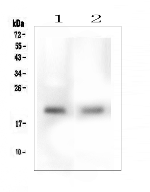 Western blot analysis of EVA1A using anti-EVA1A antibody (A11580-1). Electrophoresis was performed on a 5-20% SDS-PAGE gel at 70V (Stacking gel) / 90V (Resolving gel) for 2-3 hours. The sample well of each lane was loaded with 50ug of sample under reducing conditions. Lane 1: human HepG2 whole cell lysates, Lane 2: human PC-3 whole cell lysates. After Electrophoresis, proteins were transferred to a Nitrocellulose membrane at 150mA for 50-90 minutes. Blocked the membrane with 5% Non-fat Milk/ TBS for 1.5 hour at RT. The membrane was incubated with rabbit anti-EVA1A antigen affinity purified polyclonal antibody (Catalog # A11580-1) at 0.5 μg/mL overnight at 4°C, then washed with TBS-0.1%Tween 3 times with 5 minutes each and probed with a goat anti-rabbit IgG-HRP secondary antibody at a dilution of 1:10000 for 1.5 hour at RT. The signal is developed using an Enhanced Chemiluminescent detection (ECL) kit (Catalog # EK1002) with Tanon 5200 system. A specific band was detected for EVA1A at approximately 21KD. The expected band size for EVA1A is at 17KD.