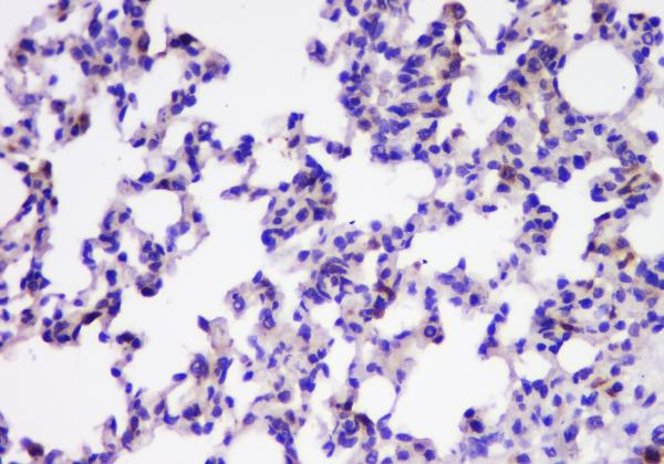 IHC analysis of TIMM17A using anti-TIMM17A antibody (A12168-1). TIMM17A was detected in paraffin-embedded section of rat lung tissue. Heat mediated antigen retrieval was performed in citrate buffer (pH6, epitope retrieval solution) for 20 mins. The tissue section was blocked with 10% goat serum. The tissue section was then incubated with 1μg/ml rabbit anti-TIMM17A Antibody (A12168-1) overnight at 4°C. Biotinylated goat anti-rabbit IgG was used as secondary antibody and incubated for 30 minutes at 37°C. The tissue section was developed using Strepavidin-Biotin-Complex (SABC)(Catalog # SA1022) with DAB as the chromogen.