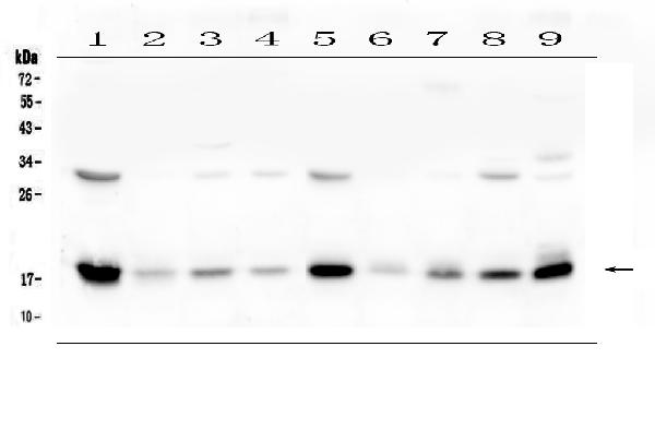 Western blot analysis of TIMM17A using anti-TIMM17A antibody (A12168-1). Electrophoresis was performed on a 5-20% SDS-PAGE gel at 70V (Stacking gel) / 90V (Resolving gel) for 2-3 hours. The sample well of each lane was loaded with 50ug of sample under reducing conditions. Lane 1: rat heart tissue lysates, Lane 2: rat lung tissue lysates, Lane 3: rat liver tissue lysates, Lane 4: rat brain tissue lysates, Lane 5: mouse heart tissue lysates, Lane 6: mouse lung tissue lysates, Lane 7: mouse liver tissue lysates, Lane 8: mouse brain tissue lysates, Lane 9: mouse Neuro-2a whole cell lysates, After Electrophoresis, proteins were transferred to a Nitrocellulose membrane at 150mA for 50-90 minutes. Blocked the membrane with 5% Non-fat Milk/ TBS for 1.5 hour at RT. The membrane was incubated with rabbit anti-TIMM17A antigen affinity purified polyclonal antibody (Catalog # A12168-1) at 0.5 μg/mL overnight at 4°C, then washed with TBS-0.1%Tween 3 times with 5 minutes each and probed with a goat anti-rabbit IgG-HRP secondary antibody at a dilution of 1:10000 for 1.5 hour at RT. The signal is developed using an Enhanced Chemiluminescent detection (ECL) kit (Catalog # EK1002) with Tanon 5200 system. A specific band was detected for TIMM17A at approximately 18KD. The expected band size for TIMM17A is at 18KD.