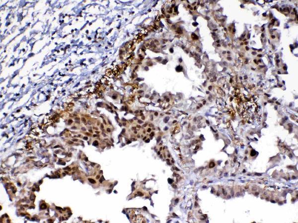A12781 MED9 primary antibodies IHC testing 3