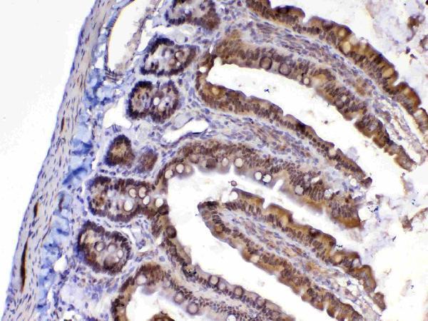 A12781 MED9 primary antibodies IHC testing 5