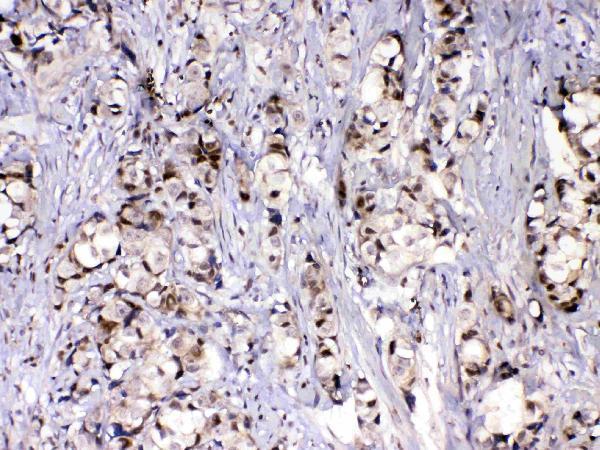 A12781 MED9 primary antibodies IHC testing 6