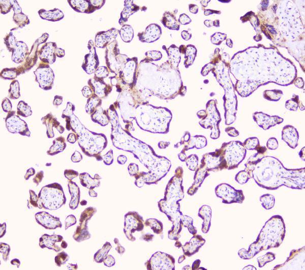 A13092 1 LRTOMT primary antibodies IHC testing 3
