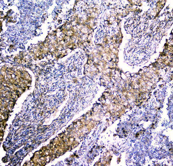 A13092 1 LRTOMT primary antibodies IHC testing 4