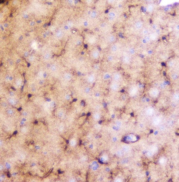 A13092 1 LRTOMT primary antibodies IHC testing 5