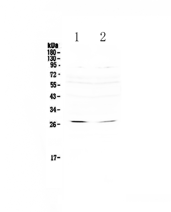 Western blot analysis of RNF186 using anti-RNF186 antibody (A15259-1).
