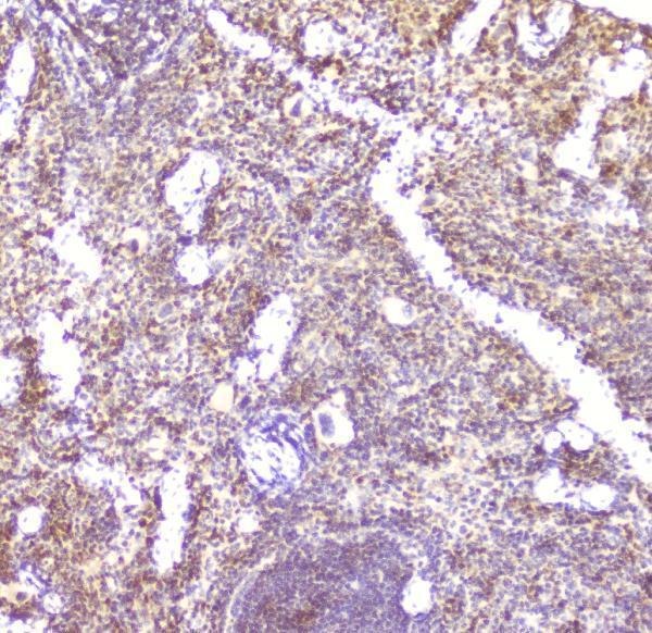 A30384 CCL6 primary antibodies IHC testing 2