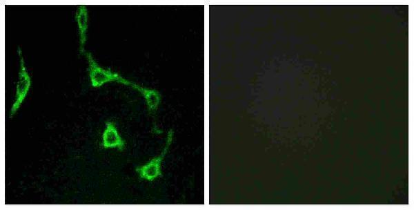 Immunofluorescence analysis of LOVO cells, using CDH10 Antibody