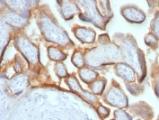 Anti-HDAC2 Antibody (Center)