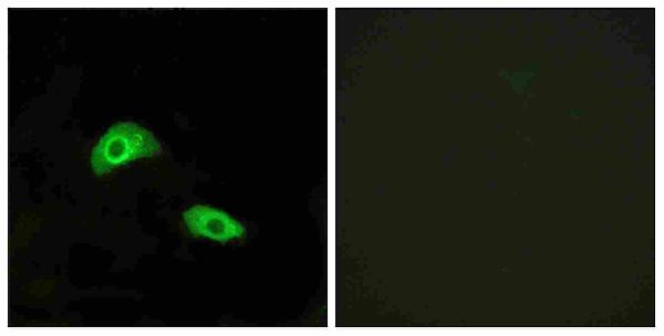 Immunofluorescence analysis of HeLa cells, using GPR174 Antibody. The picture on the right is blocked with the synthesized peptide. Immunofluorescence analysis of HeLa cells, using GPR174 Antibody. The picture on the right is blocked with the synthesized peptide.