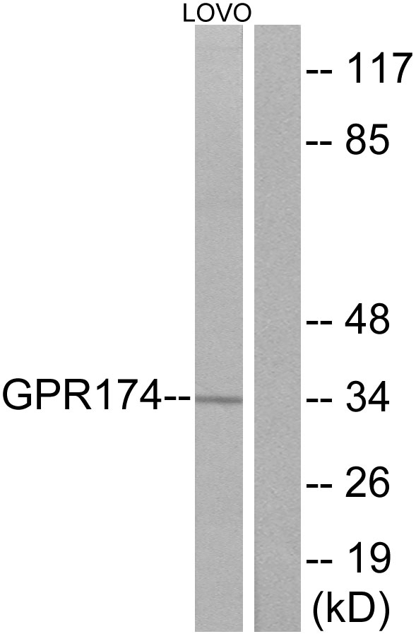 Western blot analysis of lysates from LOVO cells, using GPR174 Antibody. The lane on the right is blocked with the synthesized peptide.