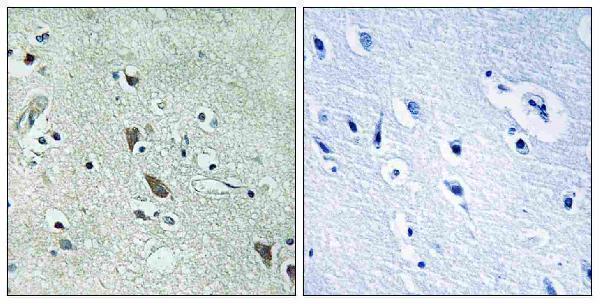 Immunohistochemistry analysis of paraffin-embedded human brain tissue, using HtrA2 Antibody