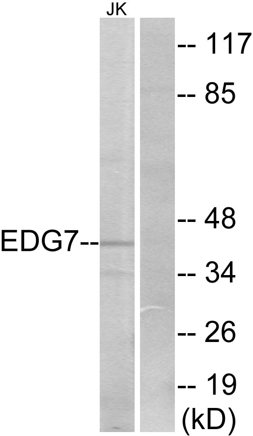 Western blot analysis of lysates from Jurkat cells, using EDG7 Antibody