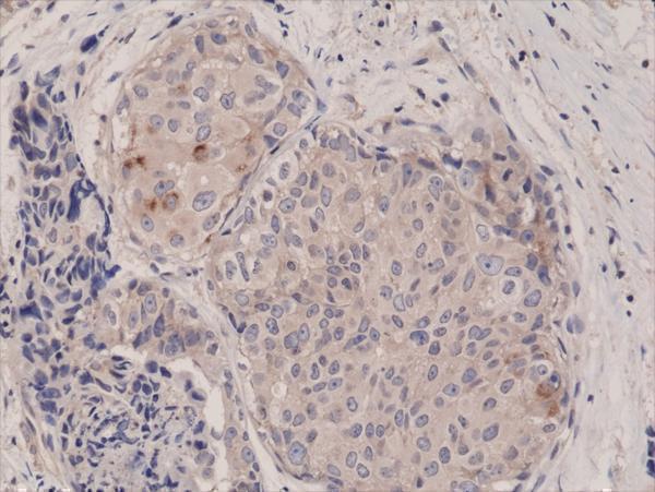 M00003 1 IHC test result image 2
