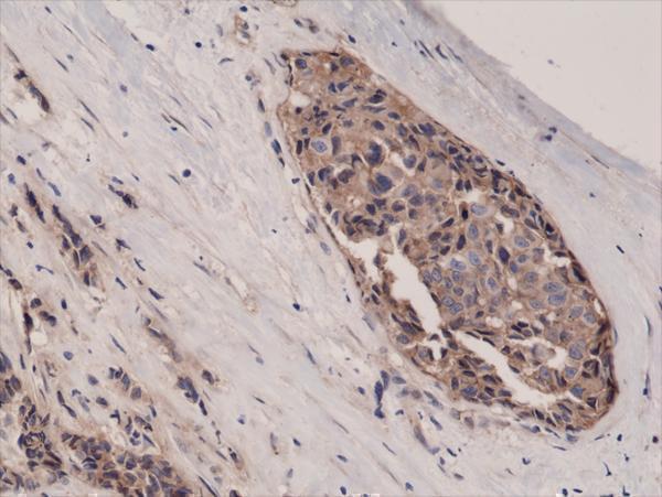 M00004 3 IHC test result image 2