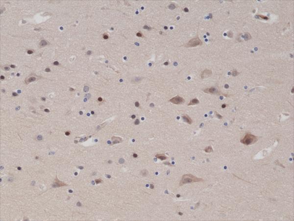  IHC resultImmunohistochemical staining of formalin fixed and paraffin embedded human brain tissue sections using Anti-PTEN Rabbit Monoclonal Antibody (Clone RM265) at a 1:1000 dilution