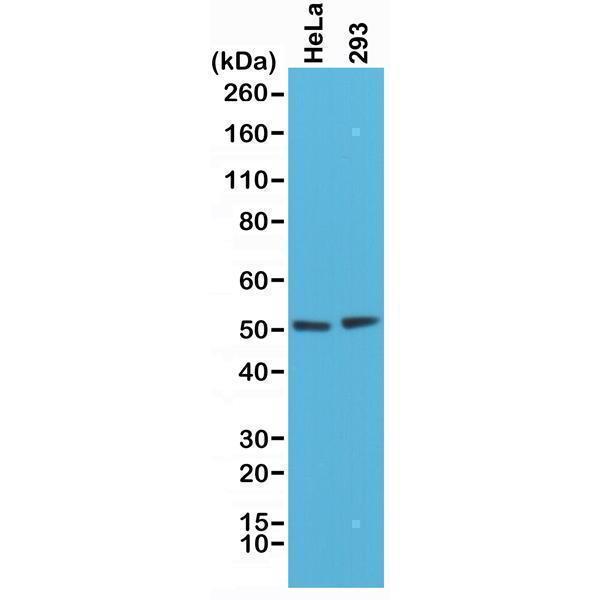  Western Blotting resultWestern Blot of HeLa and 293 cells lysates using Anti-PTEN Rabbit Monoclonal Antibody (Clone RM265) at a 1:1000 dilution