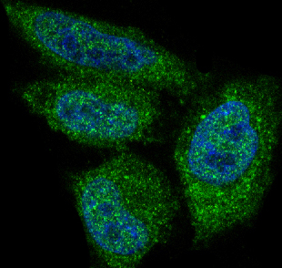 M00024 1 AKT1 IF test 3