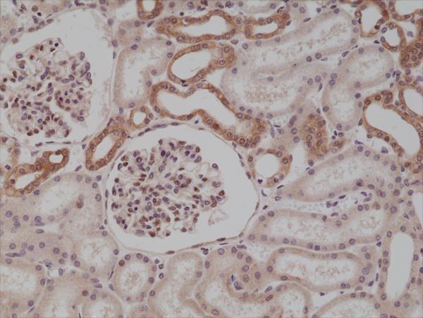  IHC resultImmunohistochemical staining of formalin fixed and paraffin embedded human kidney tissue section using anti-MyD88 rabbit monoclonal antibody (Clone RM306) at a 1:250 dilution