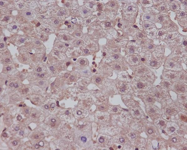 Immunohistochemical analysis of paraffin-embedded human liver, using Notch1 Antibody 