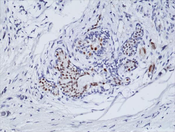 M00057 3 IHC test result image 2