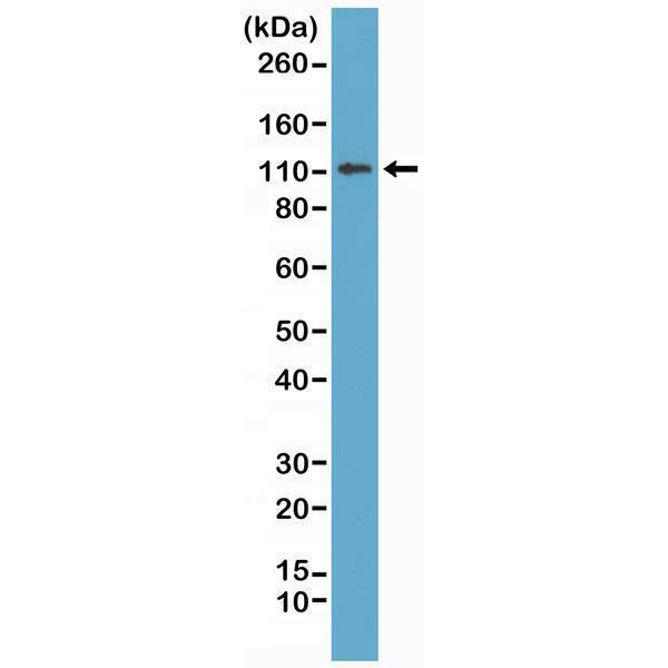 Western Blotting resultWestern Blot of MCF-7 cell lysates using Anti-E-cadherin RM244 at a 1:1000 dilution, showed a band of E-cadherin (~120 kDa) expressed in MCF-7 cells