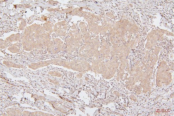 M00066 2 HMGB1 primary antibodies IHC testing 5