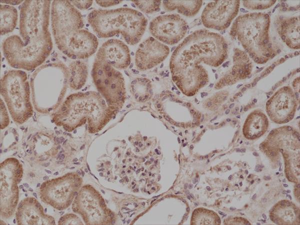  IHC resultImmunohistochemical staining of formalin fixed and paraffin embedded human kidney tissue section using anti-B-raf rabbit monoclonal antibody (Clone RM308) at a 1:500 dilution