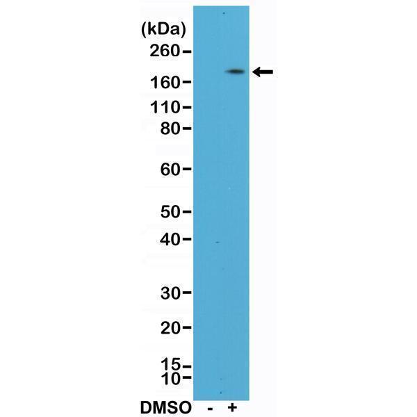  Western Blotting resultWestern Blot of HL60 cell lysates, nontreated (-) or treated (+) with DMSO using anti-CD11b rabbit monoclonal antibody (clone RM290) at a 1:400 dilution