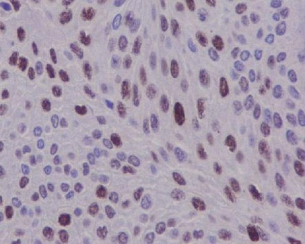 Immunohistochemical analysis of paraffin-embedded human bladder, using Cyclin D1 Antibody