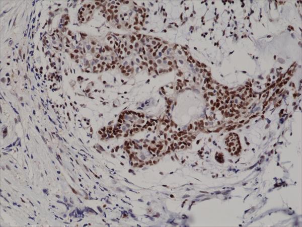 M00173 2 IHC test result image 2