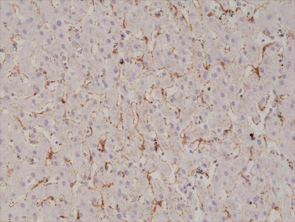 M00179 2 IHC test result image 2