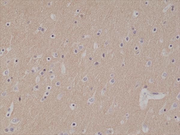  IHC resultImmunohistochemical staining of formalin fixed and paraffin embedded human brain tissue section using anti-CD56 rabbit monoclonal antibody (Clone RM315) at a 1:1000 dilution