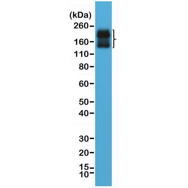  Western Blotting resultWestern Blot of human brain tissue lysate using anti-CD56 rabbit monoclonal antibody (Clone RM315) at a 1:2000 dilution