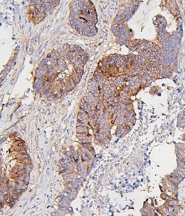 M00209 6 CDK1 primary antibodies IHC testing 2