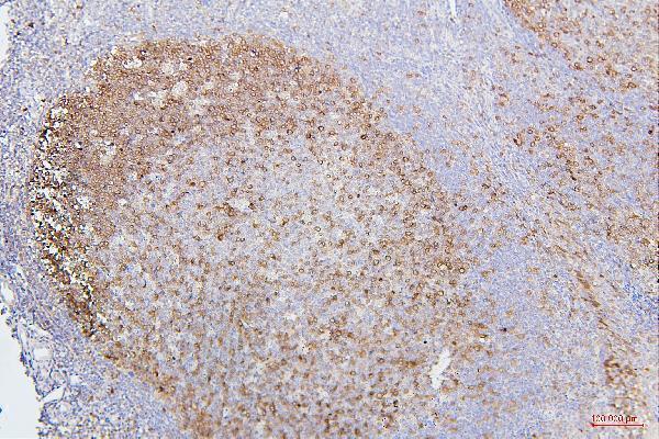 M00209 6 CDK1 primary antibodies IHC testing 3