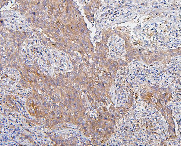 M00209 6 CDK1 primary antibodies IHC testing 4