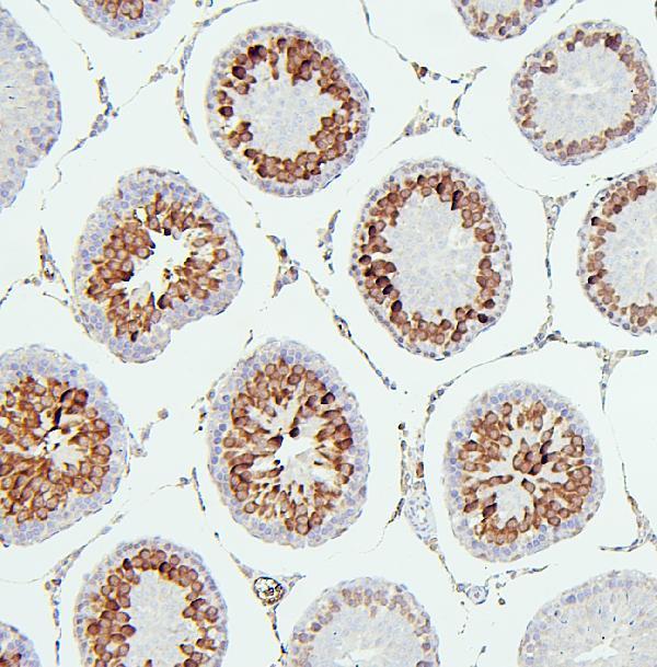 M00209 6 CDK1 primary antibodies IHC testing 6