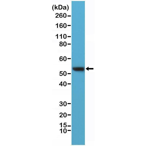  Western Blotting resultWestern Blot of HeLa lysates using anti-Vimentin rabbit monoclonal antibody (clone RM289) at a 1:400 dilution
