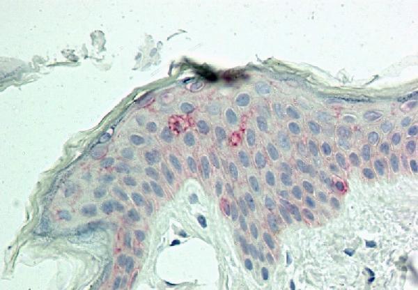 2 Immunohistochemical analysis of MITF in human Skin tissue using MITF antibody (Clone: ABM1H91) at 10 &mu