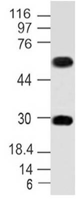 Western blot analysis of MITF