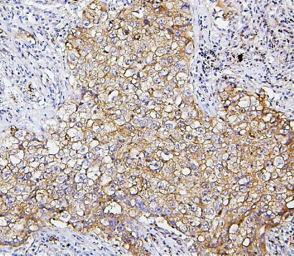 M00300 1 SQSTM1 primary antibodies IHC testing 5