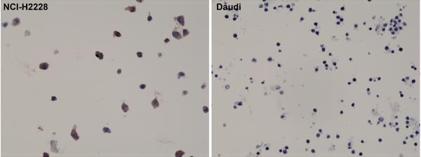 M00301 1 IHC test result image 2