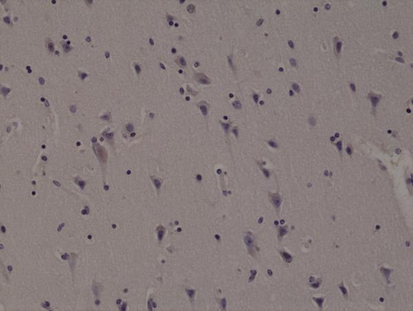 M00301 1 IHC test result image 3
