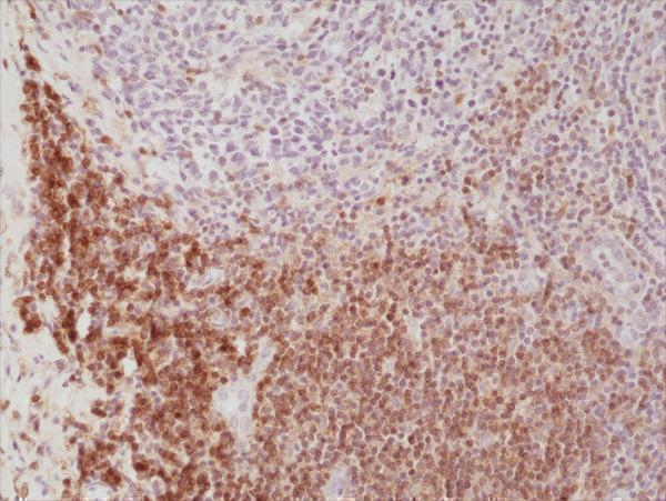  IHC resultImmunohistochemical staining of formalin fixed and paraffin embedded human Tonsil tissue section using anti-CD4 rabbit monoclonal antibody (Clone RM345) at a 1:500 dilution
