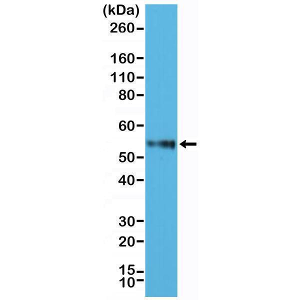  Western Blotting resultWestern Blot of Jurkat cell lysate using anti-CD4 rabbit monoclonal antibody (Clone RM345) at a 1:2500 dilution