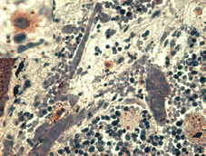 Anti-MLL KMT2A Monoclonal Antibody